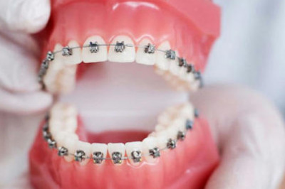 Top Orthodontists In Miami, Florida