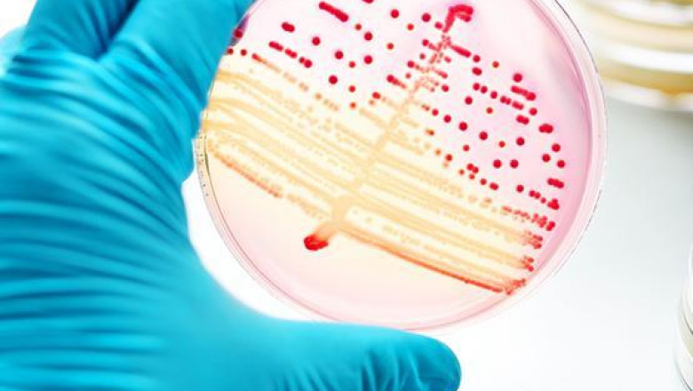 Infections with Burkholderia are pathogens that affect the human body and can cause various diseases in tropical climates