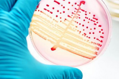 Infections with Burkholderia are pathogens that affect the human body and can cause various diseases in tropical climates