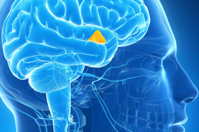 Radiation therapy or tumor removal are typically used in Acromegaly Treatment to reduce growth hormone production by pituitary glands
