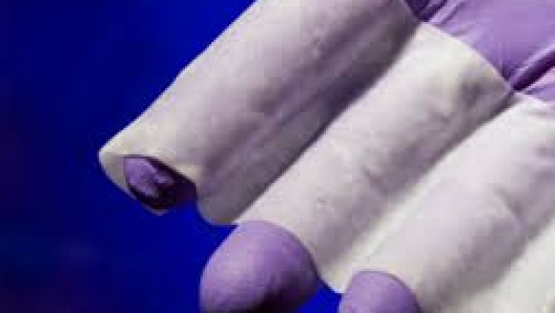 Advanced wound care management treatment uses moisture therapy, which provides moist microenvironment that stimulates the natural healing process.