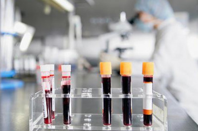 Cell-free Protein Expression involves secretion of targeted proteins in the absence of living cells with the help of biological equipment