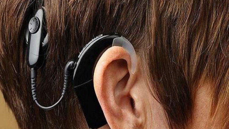 The Cost of binaural cochlear implant treatments and surgeries is the main restraining factor that is hindering the growth of the global Binaural Cochlear Implant Market