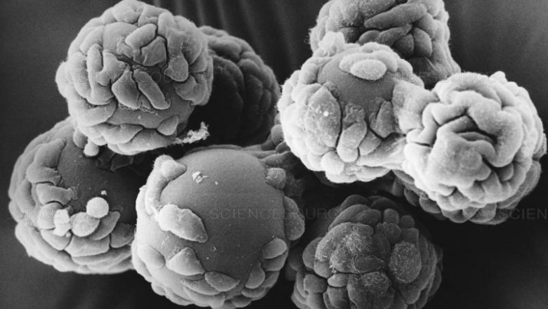 Microcarriers Market Share, Growth Opportunities, Business Revenue, Industry Players, Competitor Strategies 2027 | Lonza, GENERAL ELECTRIC COMPANY, Corning Incorporated, Sartorius AG