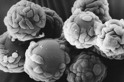 Microcarriers Market Share, Growth Opportunities, Business Revenue, Industry Players, Competitor Strategies 2027 | Lonza, GENERAL ELECTRIC COMPANY, Corning Incorporated, Sartorius AG