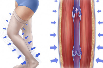 Compression Therapy Market Segments, Share, Growth, Trends, COVID 19 Impact Analysis, by 2027