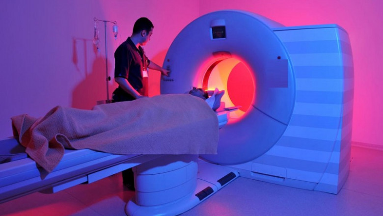 Magnetic Resonance Imaging Devices Market Overview, Analysis forecast to 2027