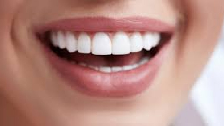 What are the Advantages Associated with Dental Bonding?