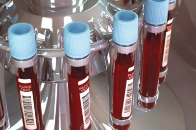 Blood Group Typing Market The Top Trends Impacting its Growth; MRFR Reveals Insights for 2019-2027