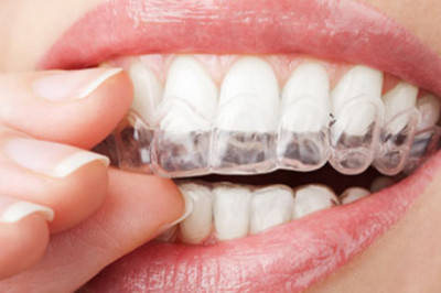 Orthodontic Supplies Market  Expected to Reach at High Pace by 2025 | Know COVID-19 Analysis | 2027