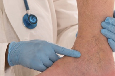 What Are The Different Types Of Vein Diseases?