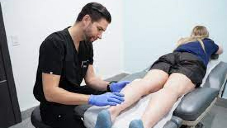 What are the Treatment Options You Can Opt for Varicose and Spider Vein Treatments?