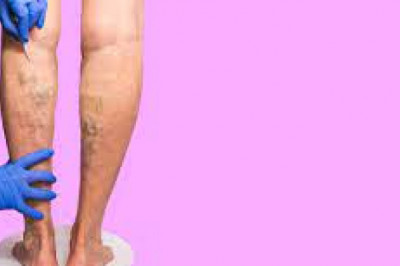 How You Can Select the Best Vein Specialists?