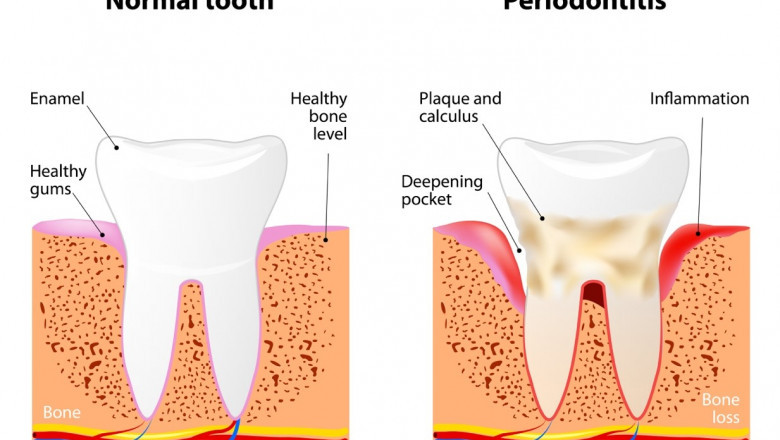 How To Choose The Best Dest Dental Services?