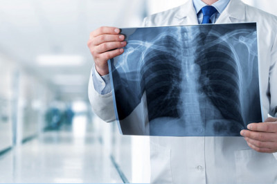 Radiology Services Market 2021 | Business Opportunities, Current Trends And Industry Analysis By 2027