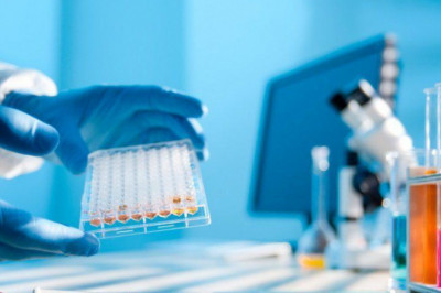 Esoteric Testing Market 2021 Share, Revenue and Cost Analysis with Key Company’s Profiles-Forecast to 2027