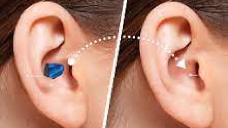 Best Invisible Hearing Aid