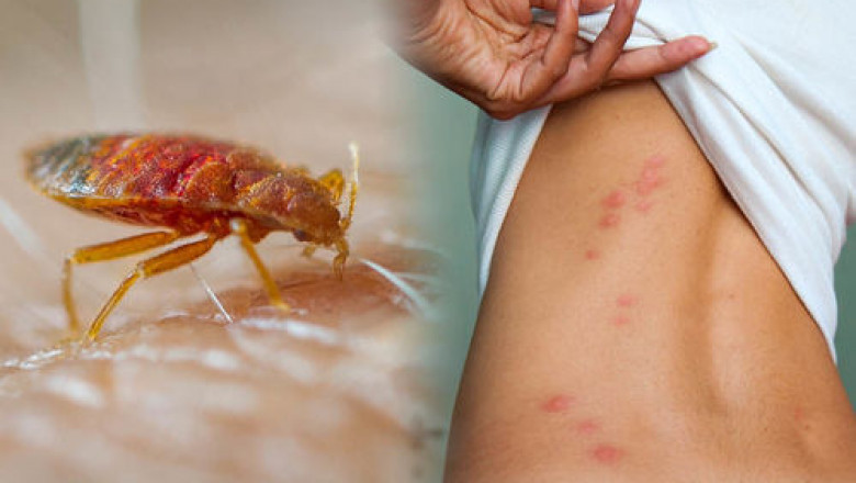 Bed Bug Treatment - How to Get Rid of Bed Bugs?