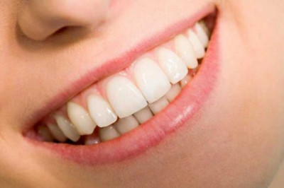 Cosmetic Dentistry Veneers