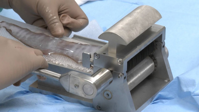 Dermatome devices are utilised in a variety of surgic plastic surgery, chronic burn care, and general surgery