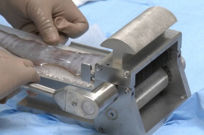 Dermatome devices are utilised in a variety of surgic plastic surgery, chronic burn care, and general surgery