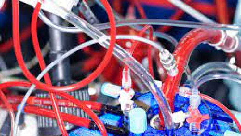 During coronary bypass heart surgery, Cardiopulmonary Bypass Equipment takes over the functions of the heart and lungs to maintain blood circulation and oxygen levels
