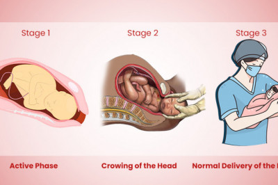 Normal Delivery in Udaipur -Meddco