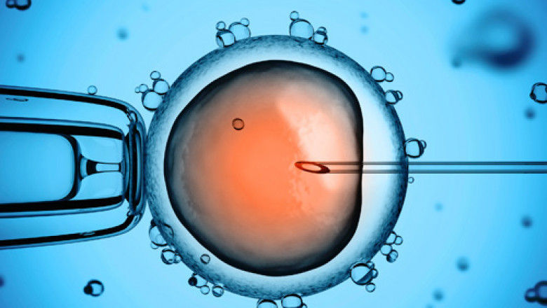 Assisted Reproductive Technology Market Revenue Analysis, Business Insights, Developments and Opportunity Assessment by 2027