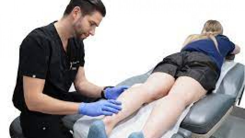 Can Exercise Be Useful Eliminating Varicose Veins?