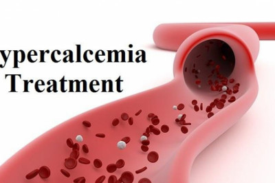 Hypercalcemia Treatment with Calcitonin: Calcium Levels In Blood Are Maintained Through Slow Bone Loss