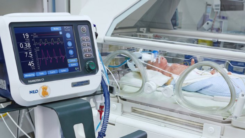 Neonatal Ventilator: Special Techniques of Respiratory Support
