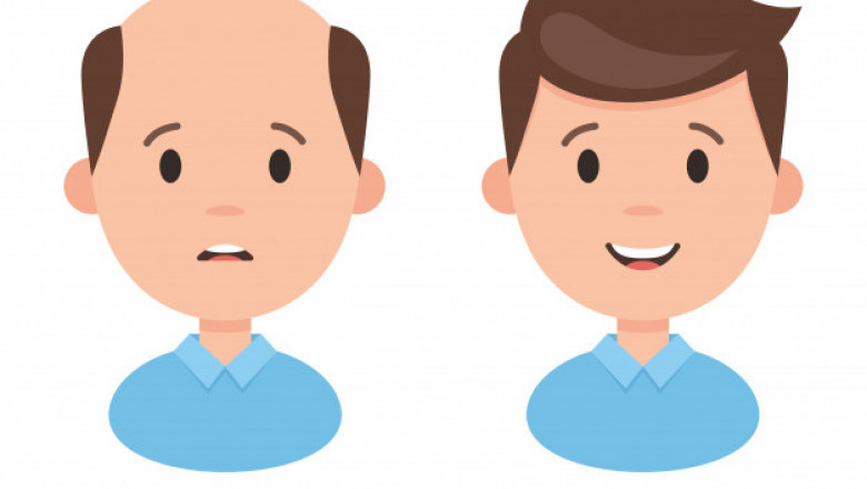 How to face the outcomes of hair loss?