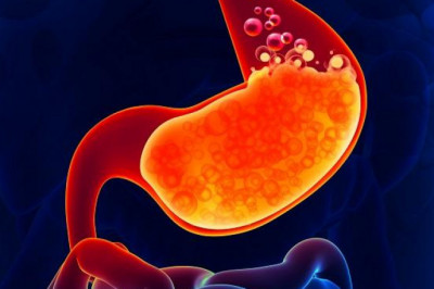 Proton Pump Inhibitors are drugs that block the production of protons in the body. Reduce Stomach Acid to Treat Stomach and Esophagus Issues
