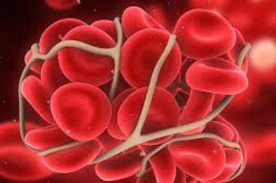 There is a continued high demand for anticoagulant reversal drugs, which are often used in surgical procedures to stop excessive bleeding