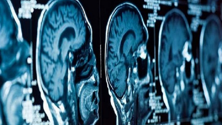 Contrast and Imaging Agents in Interventional X-ray Market research by dbmr forecast to 2028