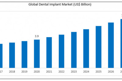 Dental Implant Market 2021 Industry Scenario with Growth Strategies, Market Dynamics, and Competitive Landscape 2027