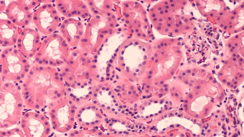 Histology and Cytology are medical branches that are important for diagnosing various diseases.