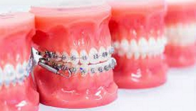 How Delta Dental PPO Plays an Important Role in Your Dental Health?