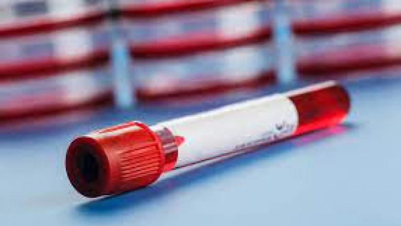 There is a growing demand for blood collection tubes in the medical sector, as they are simpler to use