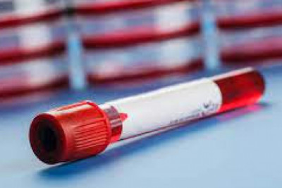 There is a growing demand for blood collection tubes in the medical sector, as they are simpler to use