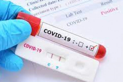 This is expected to boost the testing rates in rural areas as well and thus fuel the growth of global COVID-19 rapid diagnostic test market.