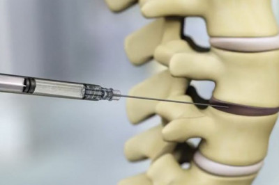 U.S. Degenerative Disc Disease Treatment; helps the body adjust to the damaged disc and manages symptoms.