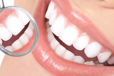 Veneers Cost Near Me