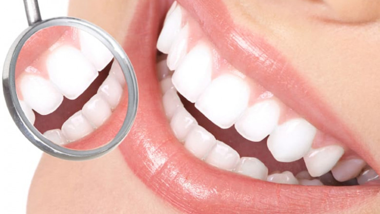 What are the Signs, Causes, and Treatments for Dental Abscess?
