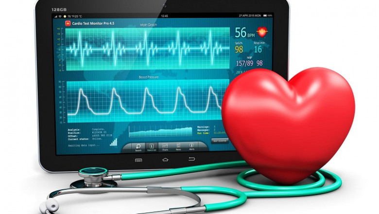 Electrophysiology Market research by dbmr forecast to 2027