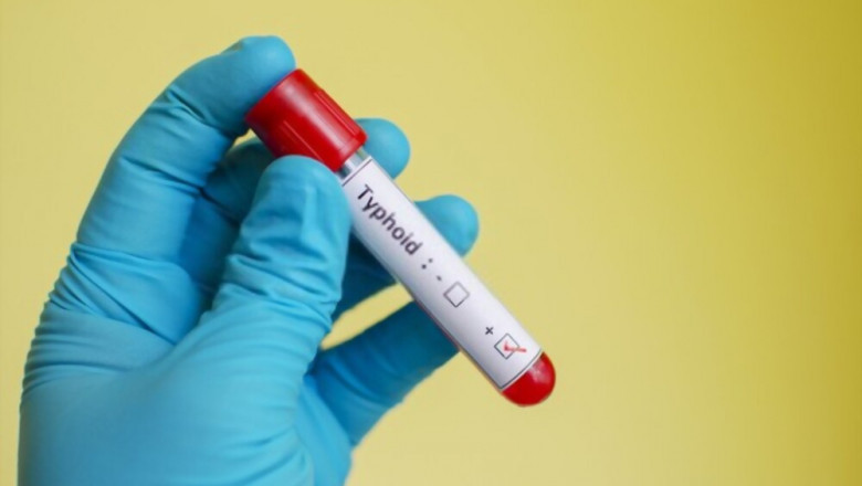 Fever Unani Medicine - Benefits of Unani Medicine in Fever