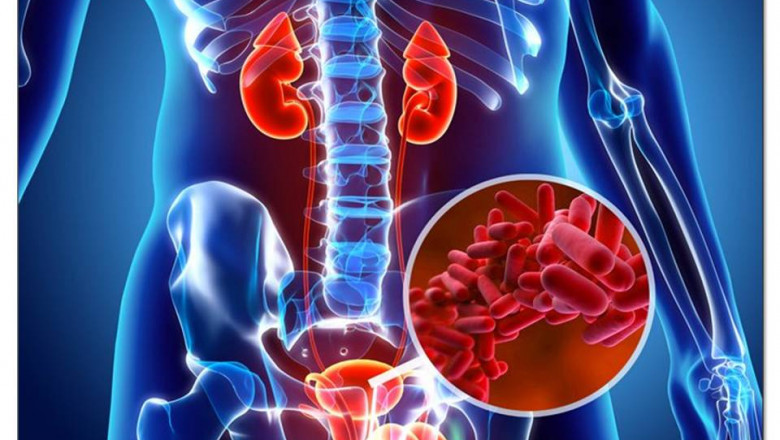 NATURAL CURE FOR KLEBSIELLA UTI (URINARY TRACT INFECTION)
