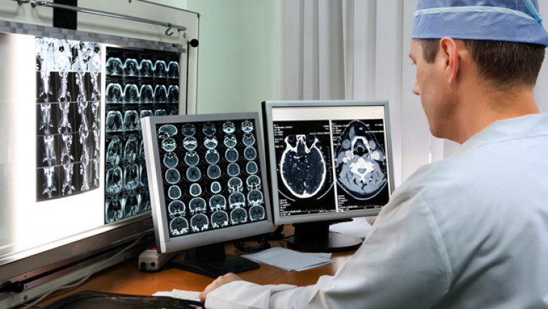 Radiology Information System (RIS) Market Analysis Report