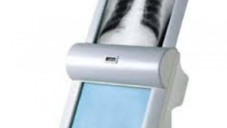 Medical X-Ray Film Processor Market Grows With Changing Consumer Preferences & New Opportunities