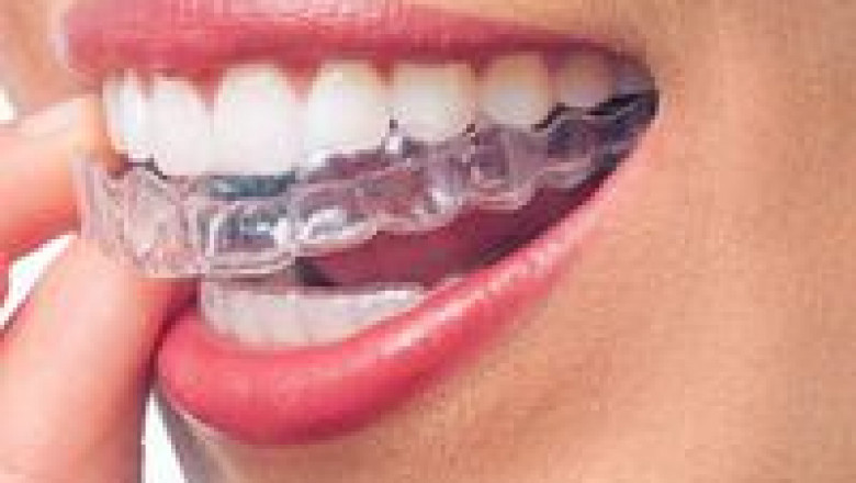 Top Orthodontics Treatment